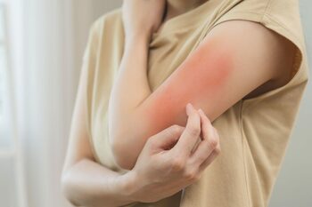 Poți fi alergic la alți oameni? Răspunsul te va surprinde!