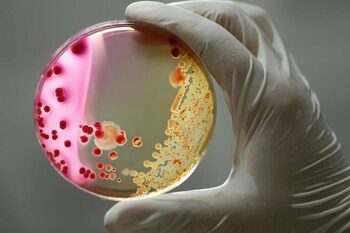 OMS: Bacteriile devin tot mai puternice, iar antibioticele tot mai slabe. Una din șase infecții bacteriene este (…)