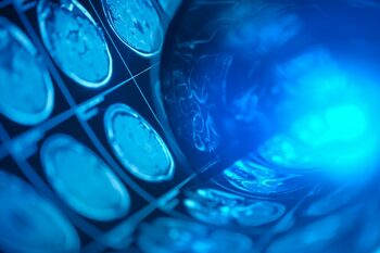O singură scanare cerebrală poate dezvălui cât de repede îmbătrânești
