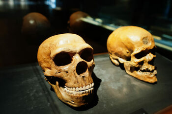 O anomalie cerebrală la oamenii moderni își are originea în ADN-ul neanderthalian străvechi