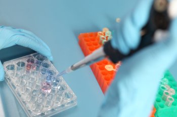 Un donator de spermă cu o mutație genetică gravă, a devenit tată pentru aproape 200 de copii în Europa / Copiii pot (…)