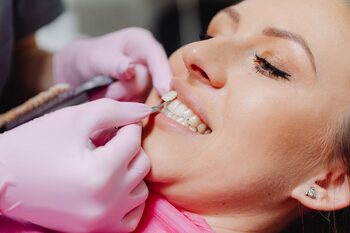 De la fațete la coroane dentare – tratamente personalizate la Angelescu Dental Clinic