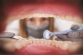 Bacteriile orale ar putea cauza atacuri de cord, sugerează un nou studiu