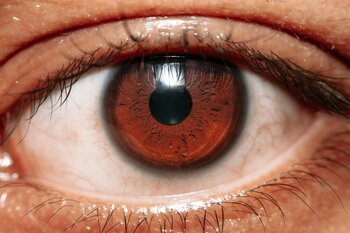 Un implant ocular a redat vederea la pacienţi cu degenerescenţă maculară legată de vârstă