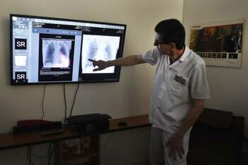 „Plămânul pe cip” care respiră ca unul real: descoperire ce promite să schimbe cercetarea medicală