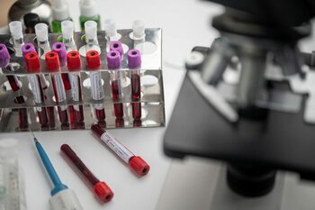O simplă analiză de sânge ar putea detecta cancerul ovarian, în stadii incipiente