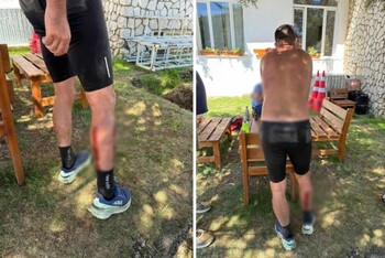 Incident grav la Stâna de Vale. Un antrenor de atletism a fost atacat de o haită de câini