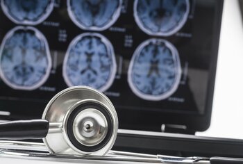 O substanţă prezentă natural în organism ar putea încetini evoluţia bolii Alzheimer