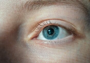 Ochii care nu sunt perfect rotunzi, predispuși la astigmatism