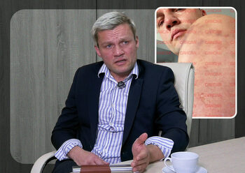 Super-modelul Andre Bîrleanu rupe tăcerea, după acuzațiile fostei partenere: „Am fost bătut”