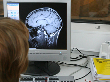 Modificările care au loc în creier atunci când ne deconectăm din cauza oboselii