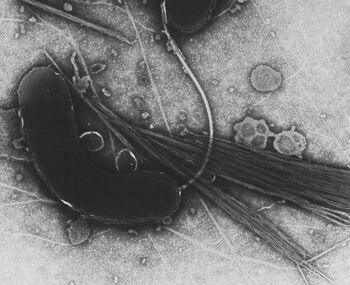 Sudanul, lovit de cea mai gravă epidemie de holeră din ultimii ani