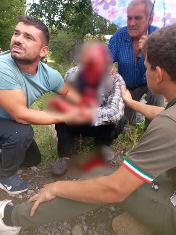 Incident îngrozitor! Un bărbat a fost atacat de urs